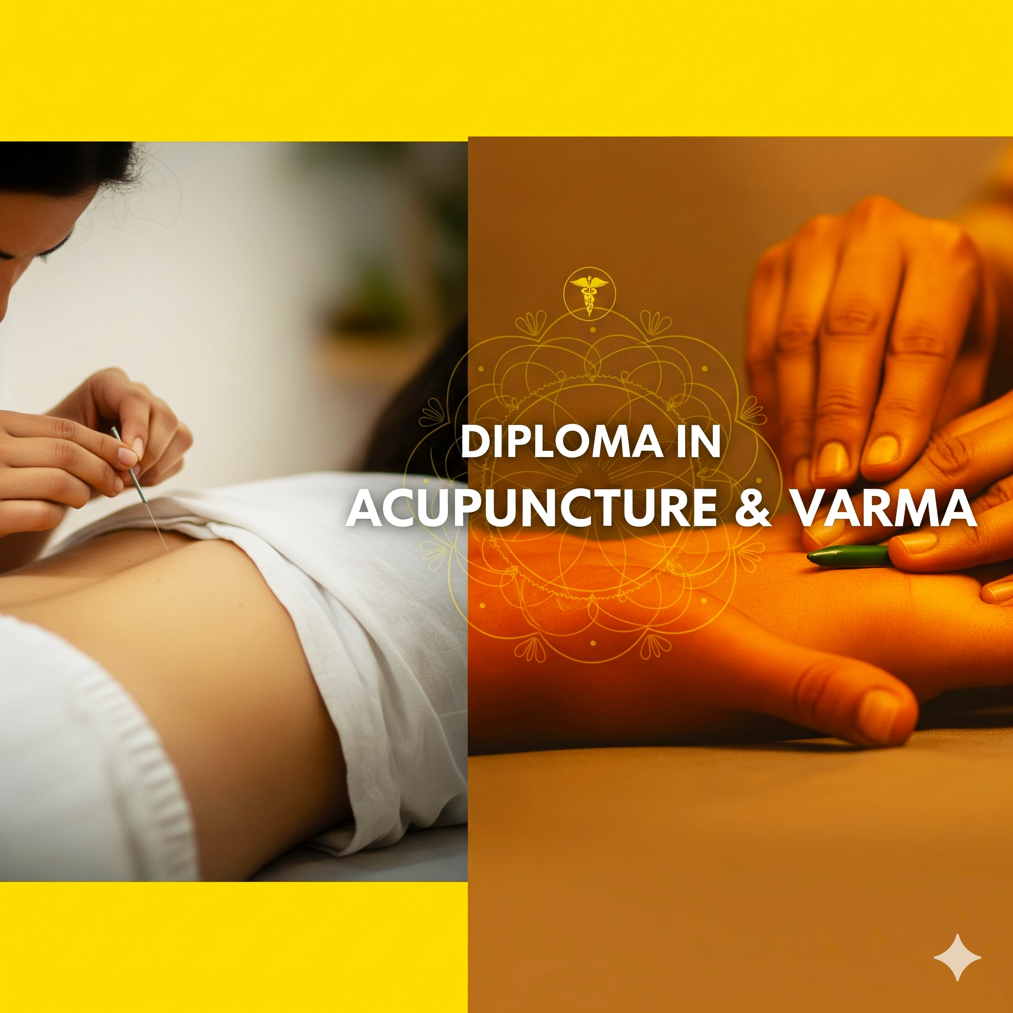 Diploma in Acupuncture and Varma Madurai, Tamil Nadu